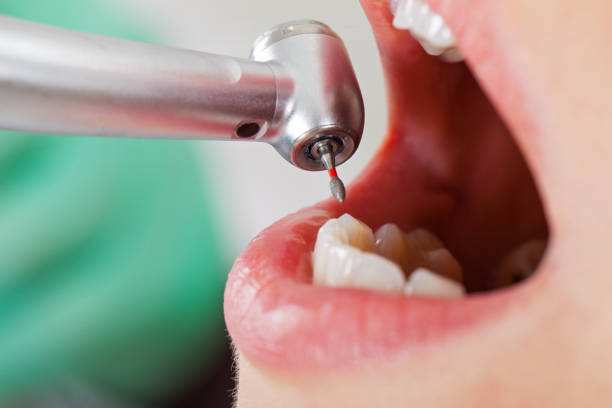 Best Dental Abscess Treatment in Negaunee, MI